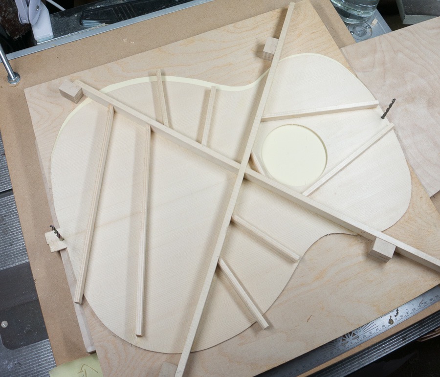 All braces on and glue cleaned up.jpg